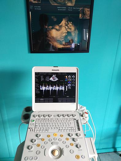 Gebraucht Philips CX50 Ultrasound with S5-1 and Trolly
