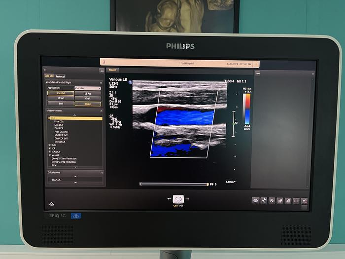 Used Philips EPIQ 5G Ultraschallgerät mit zwei Sonden