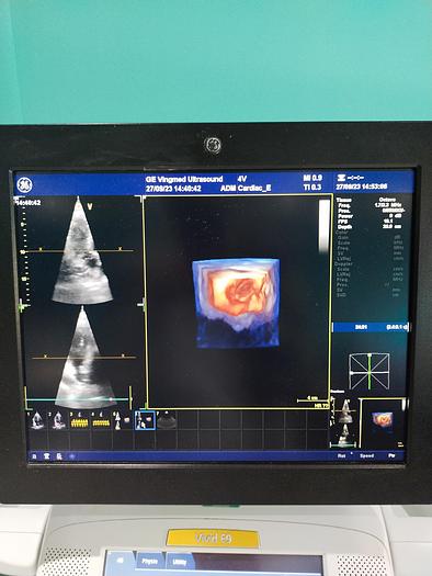 Gebraucht GE Vivid E9 Ultraschallgerät