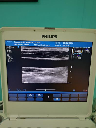 Gebraucht Philips CX50 Ultraschallgerät
