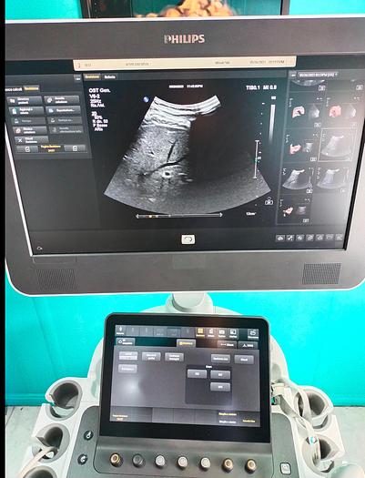 Gebraucht Philips V6-2  3D/4D  Volumen Ultraschallsonde