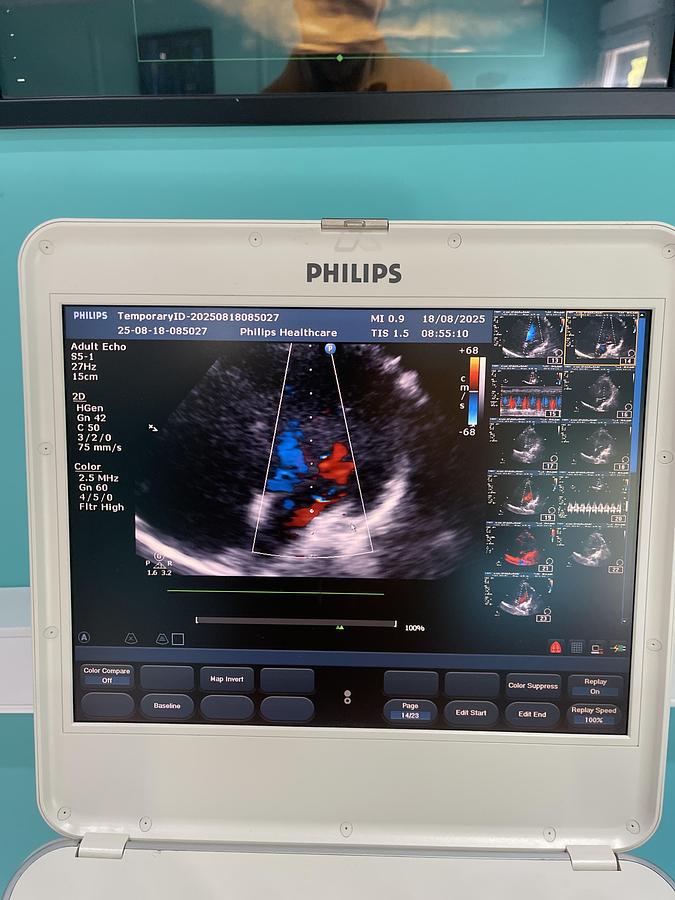 Gebraucht Philips CX50 Ultraschallgerät mit S5-1 Kardiosonde