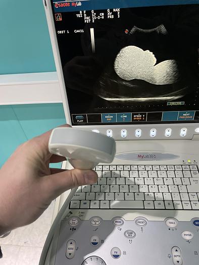 Gebraucht Esaote MyLab30CD Ultraschallgerät mit zwei Sonden