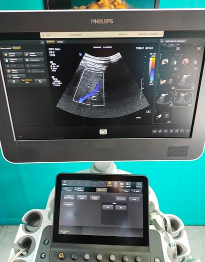 Gebraucht Philips V6-2  3D/4D  Volumen Ultraschallsonde