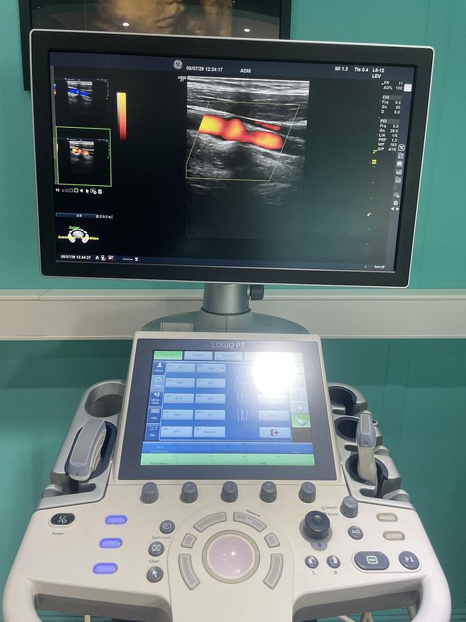 Gebraucht GE LOGIQ P7 Ultraschallgerät mit zwei Sonden