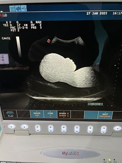 Gebraucht Esaote MyLab30CD Ultraschallgerät mit zwei Sonden