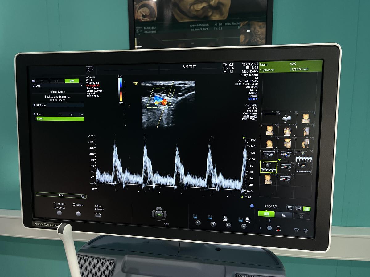 Gebraucht GE Voluson S8 Ultraschallgerät mit drei Sonden und Drucker