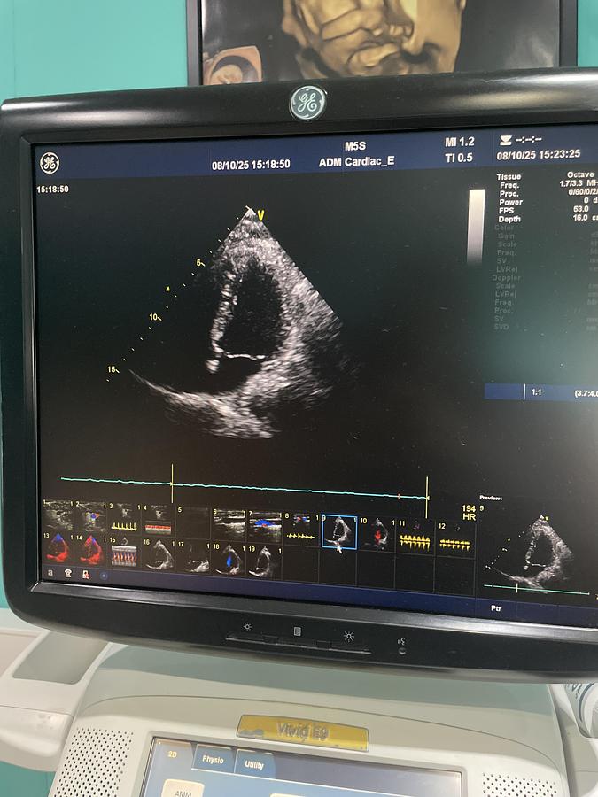 Gebraucht GE Vivid E9 Ultraschallgerät mit zwei Sonden und Drucker