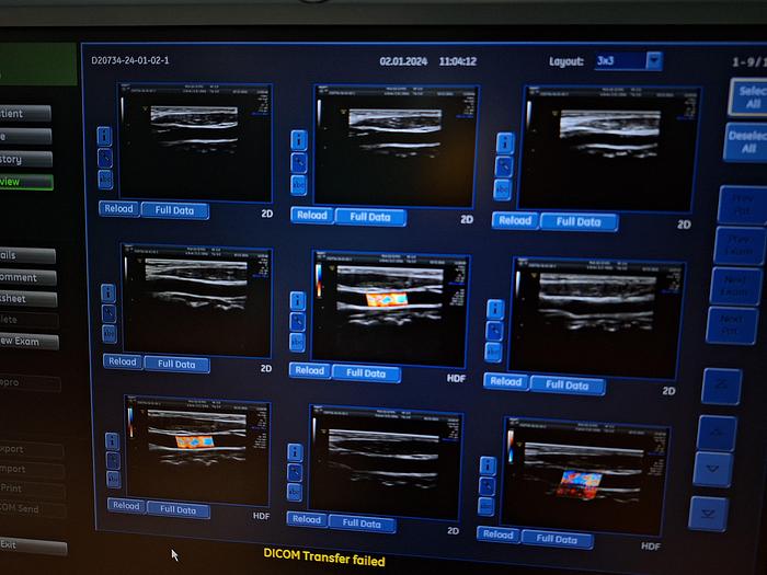 Gebraucht GE ML6-15-D Ultraschallsonde 