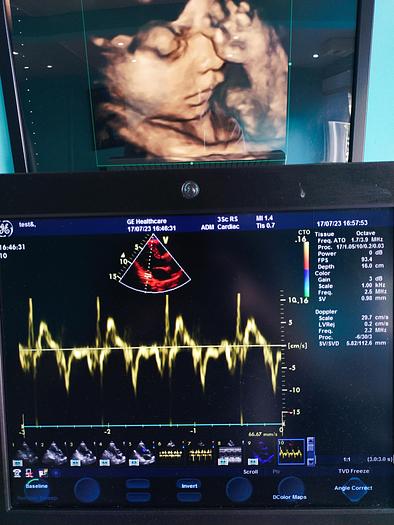 Gebraucht GE  Vivid S5  Ultraschallgerät auf Trolley mit 2 Sonden und EKG Kabel
