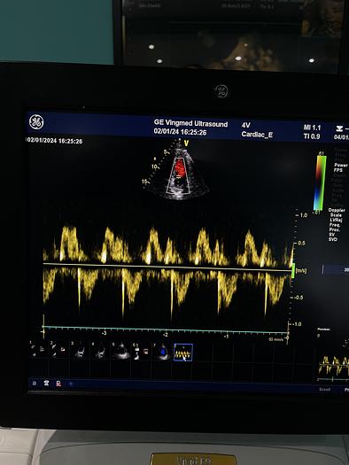 Gebraucht GE Healthcare Vivid E9 Ultraschall Gerät mit zwei Sonden