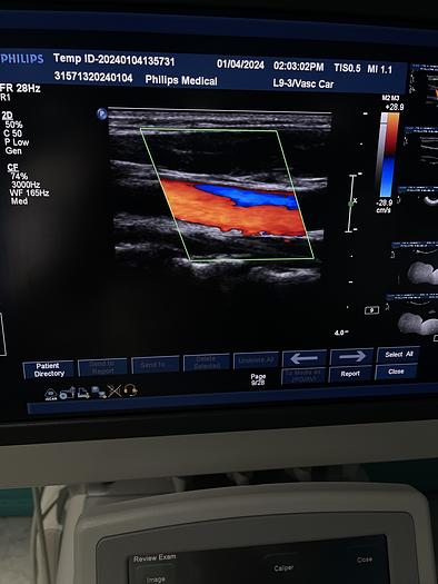 Gebraucht Philips iU22 Ultraschallgerät mit drei Ultraschallsonden