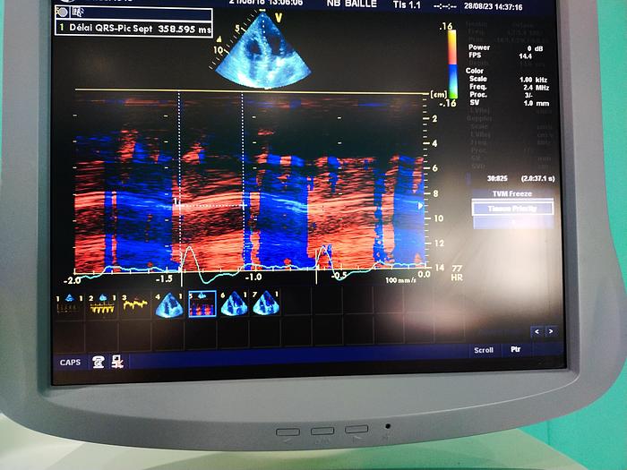 Gebraucht GE Vivid 7 Ultraschallgerät
