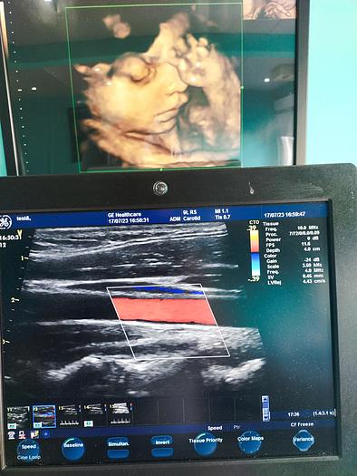 Gebraucht GE  Vivid S5  Ultraschallgerät auf Trolley mit 2 Sonden und EKG Kabel