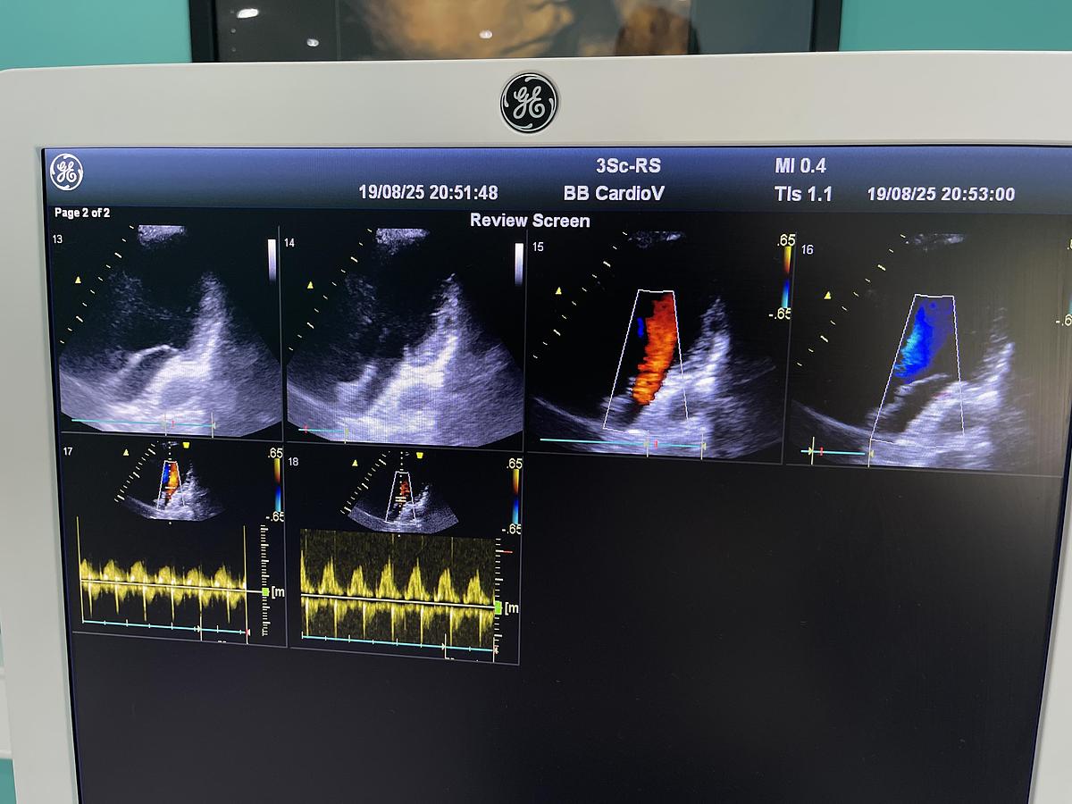 Gebraucht GE Vivid T8 Ultraschallgerät mit 3Sc-RS Kardiosonde