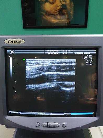 Gebraucht  GE-Voluson 730 Expert Ultraschallgerät 