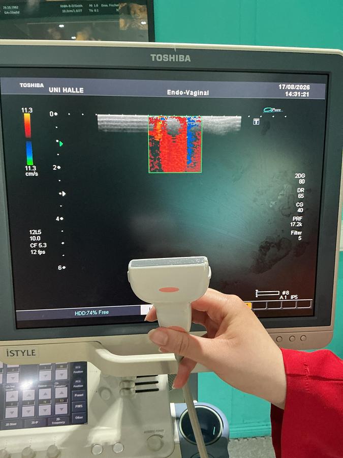 Gebraucht Toshiba/ Canon PLT-805AT Linear Ultraschallsonde