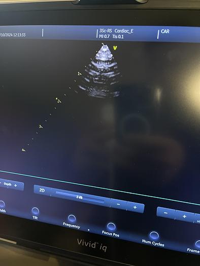 Used GE 3SC-RS Sektor Ultraschallsonde 