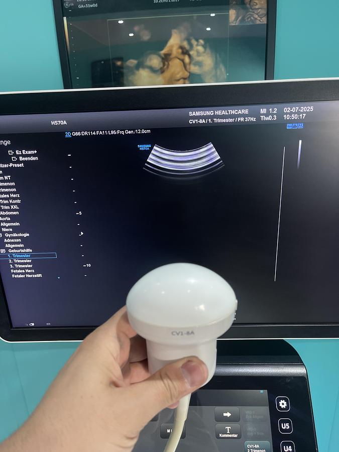 Gebraucht Samsung HS70A Ultraschallgerät mit drei Sonden