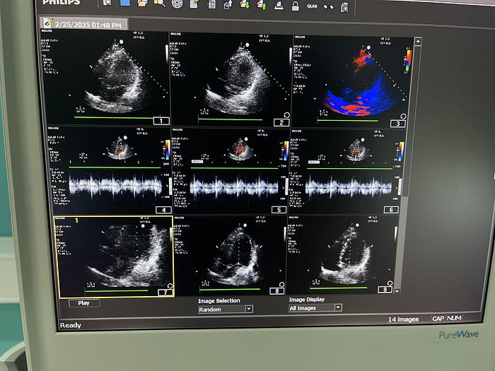 Gebraucht Philips CX50 Ultraschallgerät HW C.0 mit Sektor Sonde