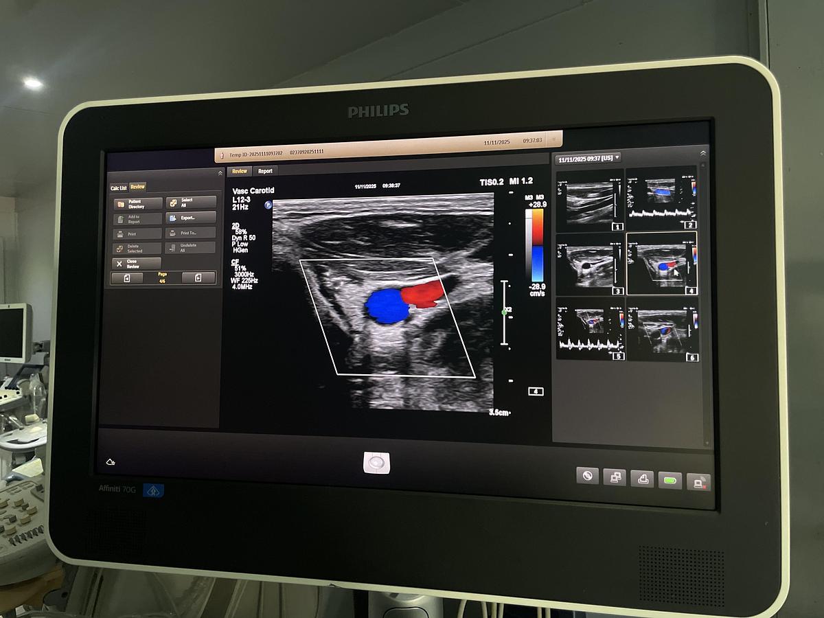 Gebraucht Philips L12-3 Linear Ultraschallsonde 