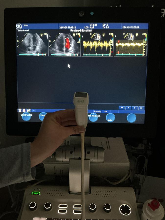 Gebraucht GE M4s-RS Kardio Ultraschallsonde