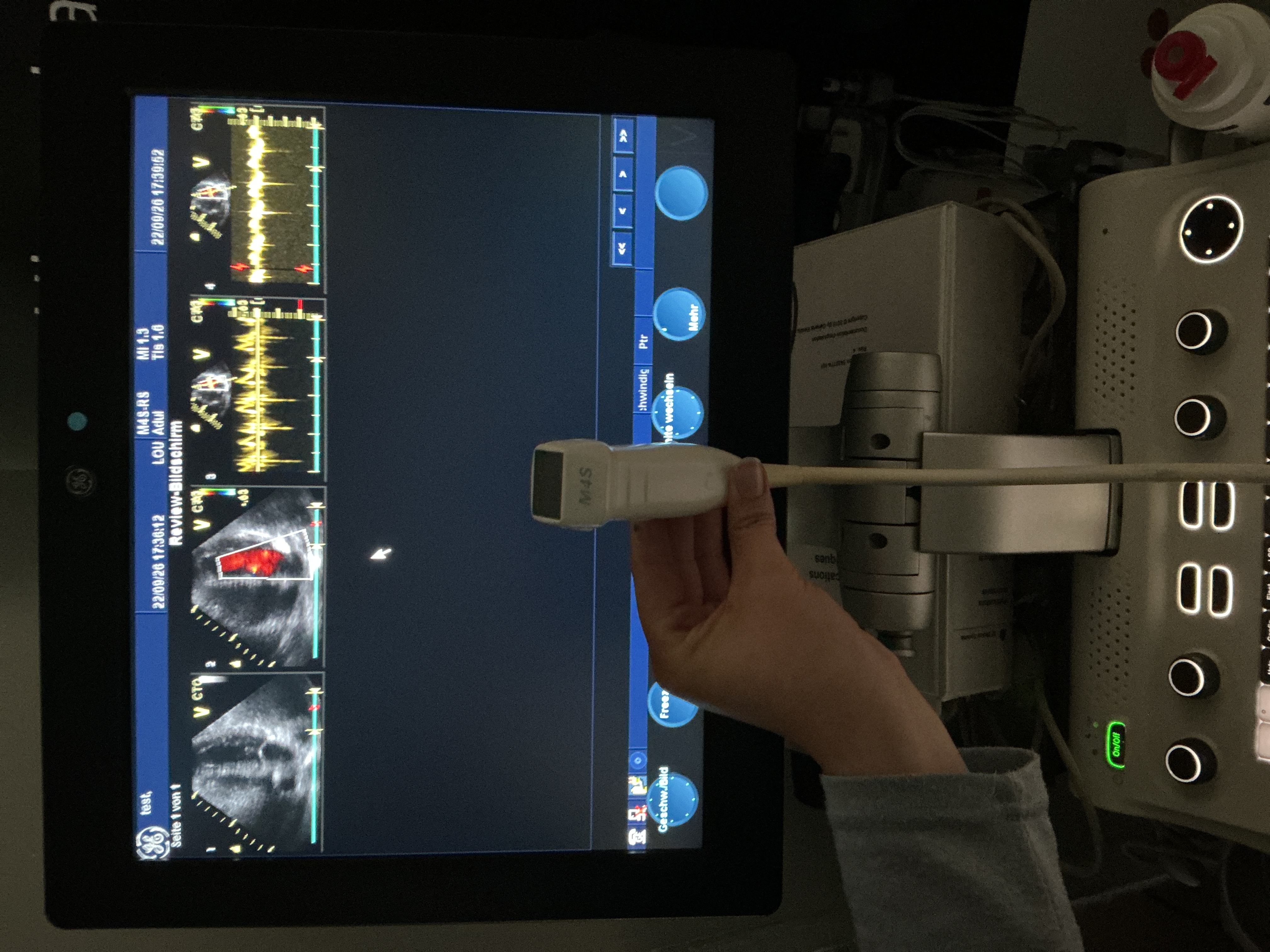 Gebraucht GE M4s-RS Kardio Ultraschallsonde