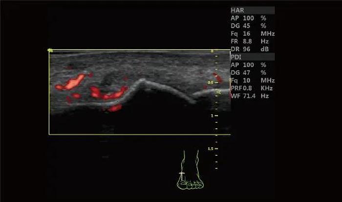 Vinno 5 tragbares Ultraschallgerät