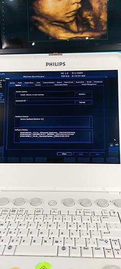 Gebraucht Philips CX50 Ultraschallgerät mit Sektor Sonde SW 2.5.1