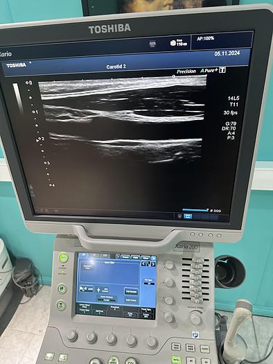 Used Toshiba Xario 200 Ultraschallgerät mit drei Sonden und Drucker 