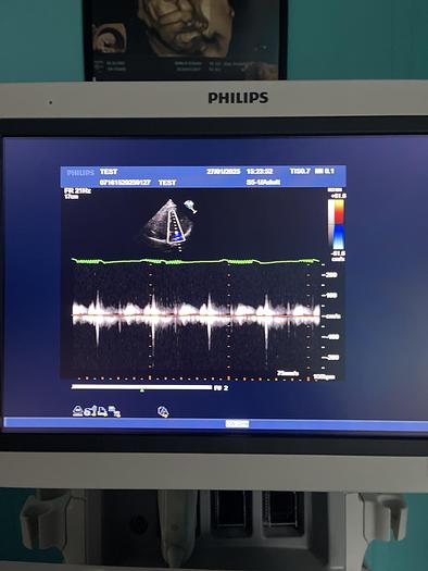 Used Philips iE33 HW G.1  xMatrix Ultraschallgerät mit S5-1 Kardiosonde und Drucker