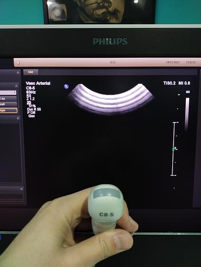 Gebraucht Ultraschallgerät Philips EPIQ 5G