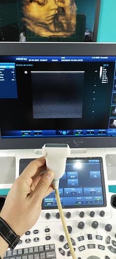 Gebraucht Mindray  DC-8 Ultraschallgerät mit 3 Sonden 