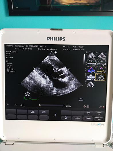 Gebraucht Philips CX50 Ultrasound with S5-1 and Trolly