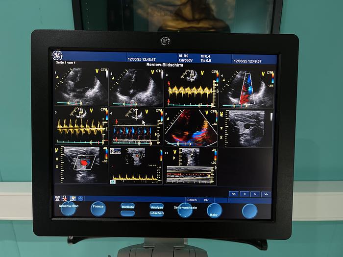 Gebraucht GE Vivid S5 Ultraschallgerät mit zwei Sonden 