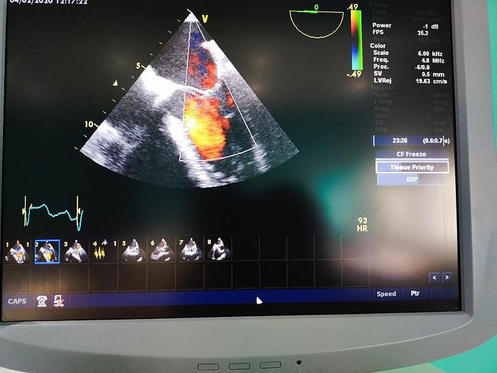 Gebraucht GE Vivid 7 Ultraschallgerät