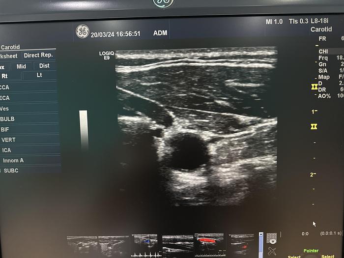 Gebraucht GE L8-18i-D Linear Ultraschallsonde