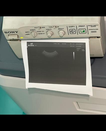 Used EDAN U2 Ultraschallgerät mit drei Sonden und Drucker