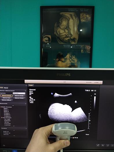 Gebraucht Ultraschallgerät Philips EPIQ 5