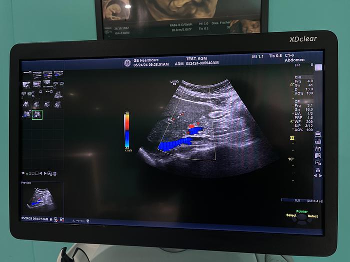 Gebraucht GE LOGIQ E9 XDClear 2.0 SW R6 Ultraschallgerät