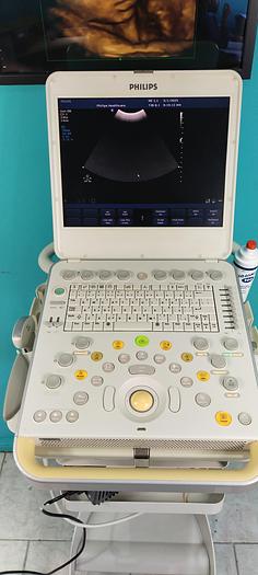 Gebraucht Philips CX50 Ultraschallgerät mit Konvex Sonde SW 2.5.1