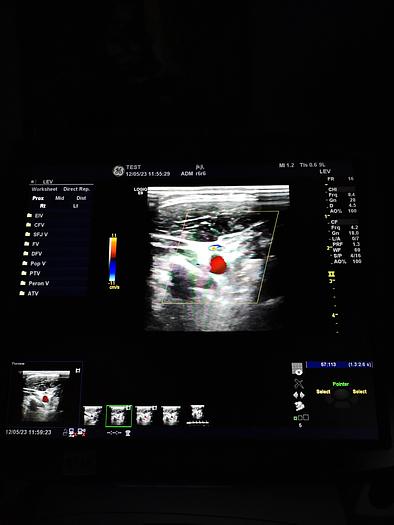 Gebraucht GE LOGIQ E9 Flachbildschirm-Ultraschallgerät inkl. 1 Sonde, Drucker und DVD-Brenner
