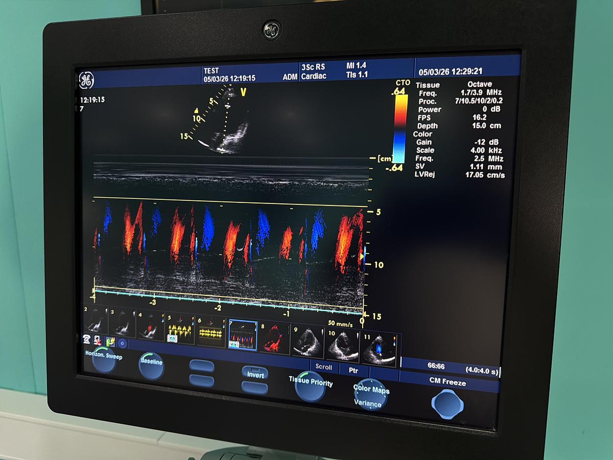 Gebraucht GE Vivid S6 Ultraschallgerät mit 3Sc-RS kardio Sonde