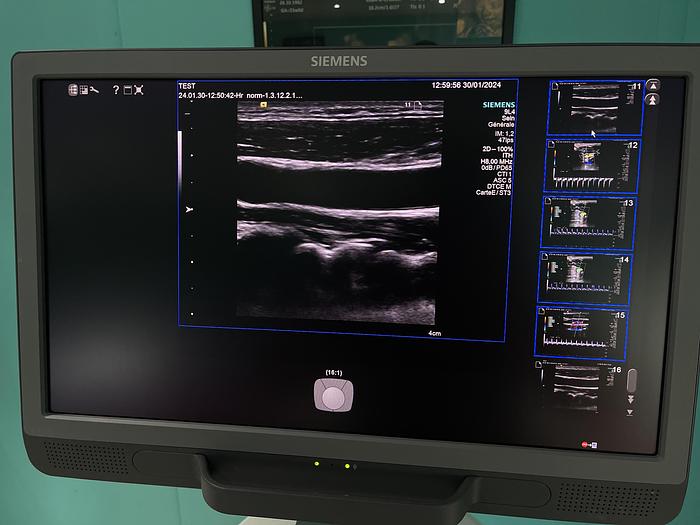 Gebraucht HELX Evoulution Acusion S2000 von Siemens Ultraschall Gerät mit drei Sonden