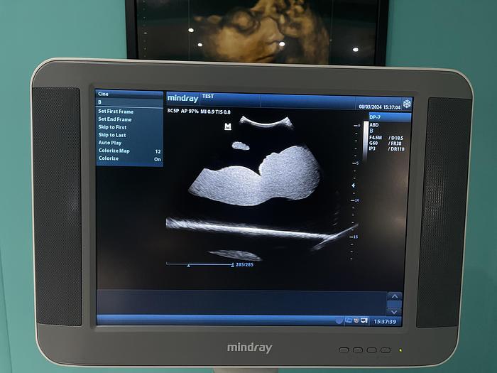 Gebraucht Mindray DP-7 Ultraschallgerät mit eine Sonde