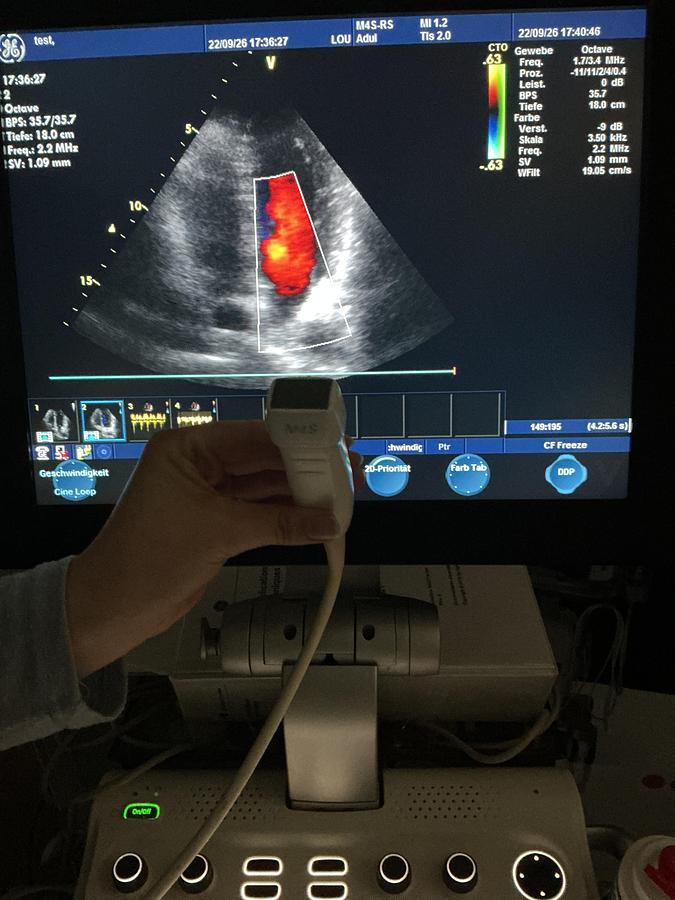 Gebraucht GE M4s-RS Kardio Ultraschallsonde