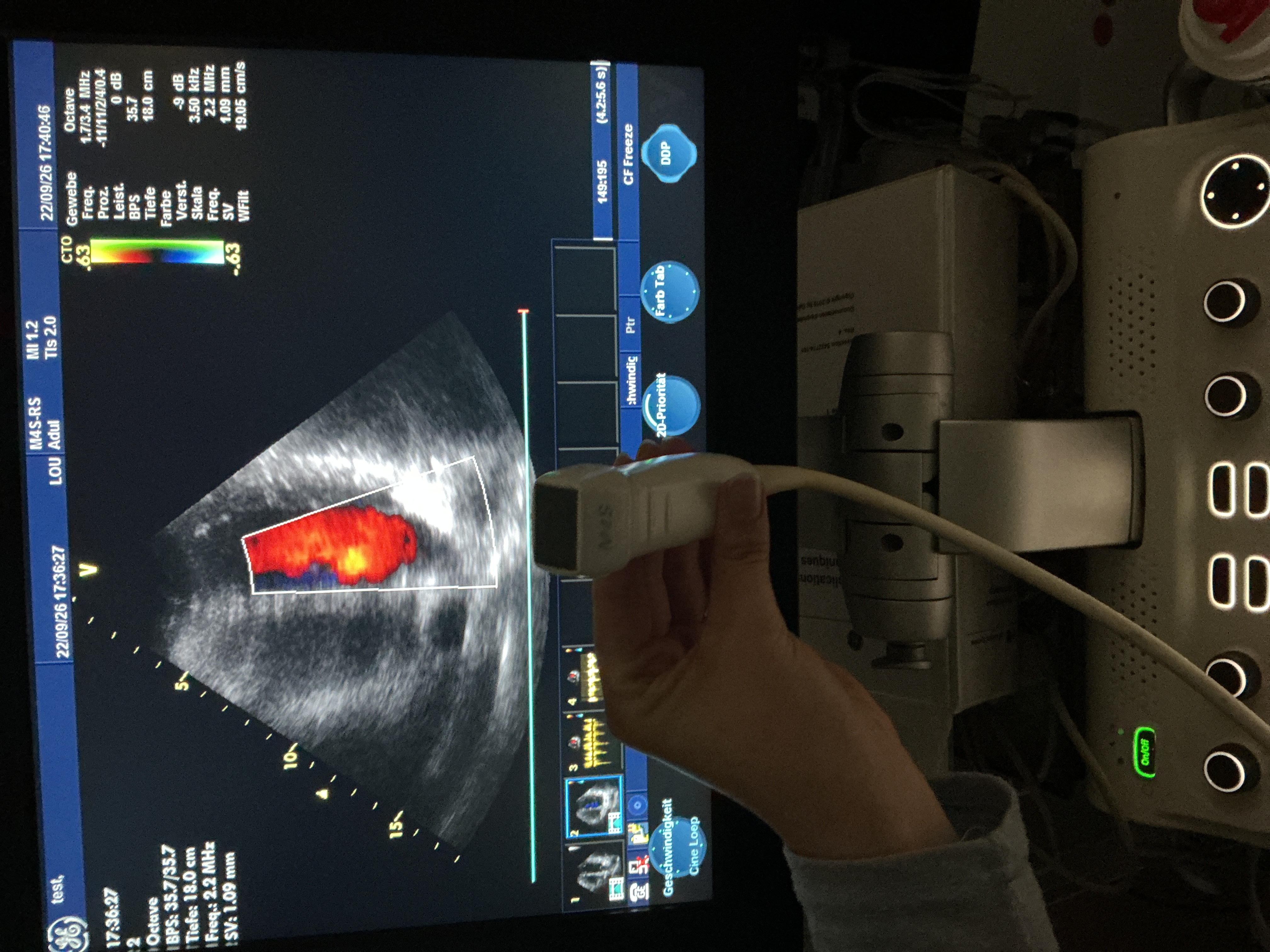 Gebraucht GE M4s-RS Kardio Ultraschallsonde