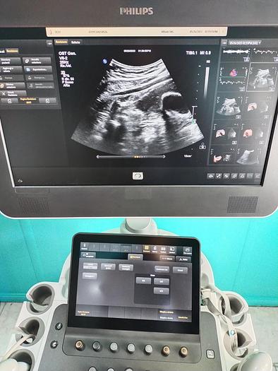 Gebraucht Philips V6-2  3D/4D  Volumen Ultraschallsonde