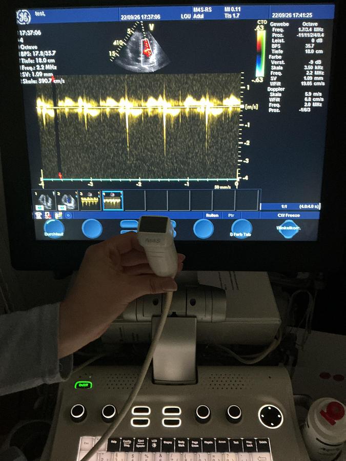Gebraucht GE M4s-RS Kardio Ultraschallsonde