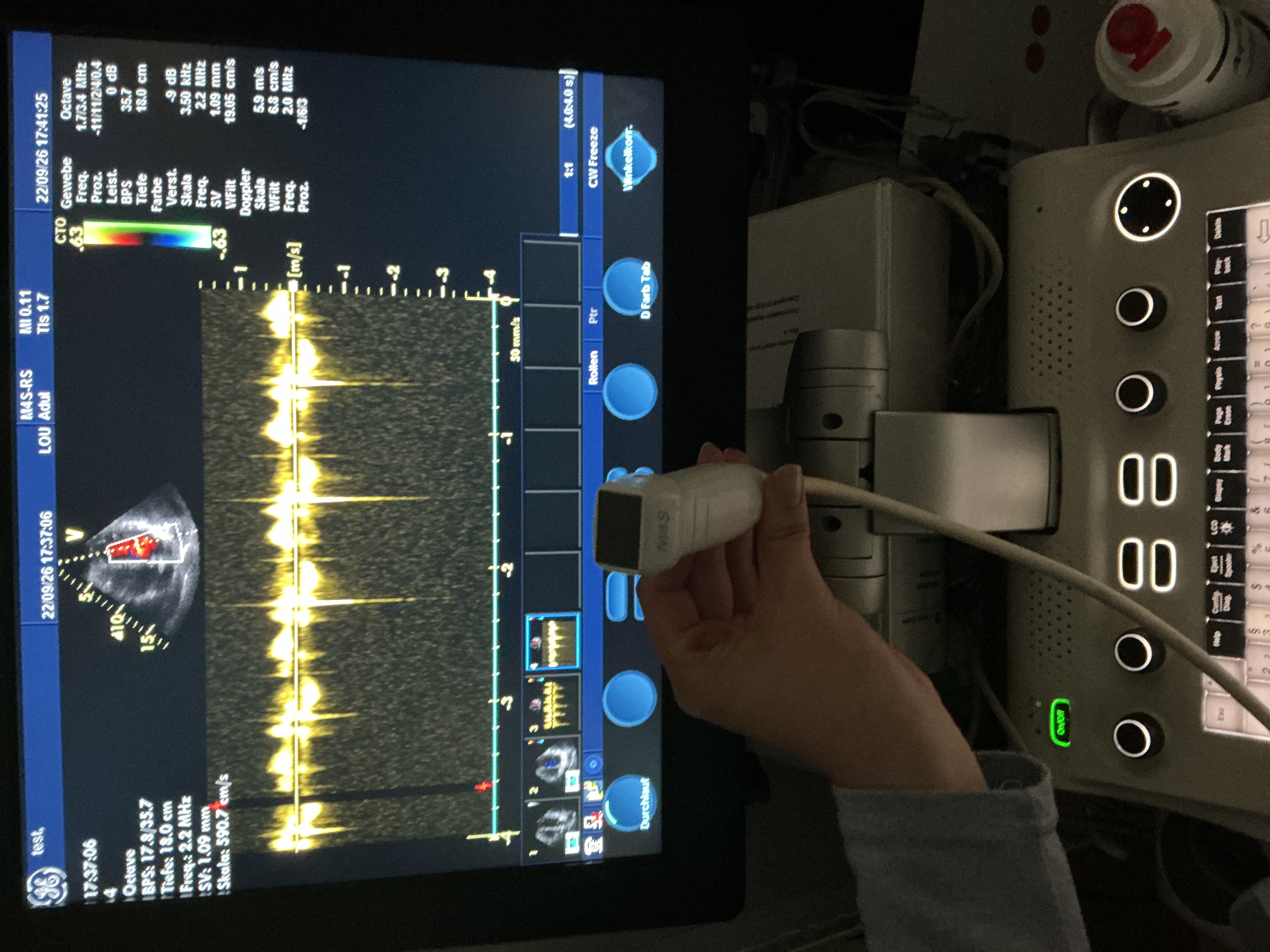 Gebraucht GE M4s-RS Kardio Ultraschallsonde